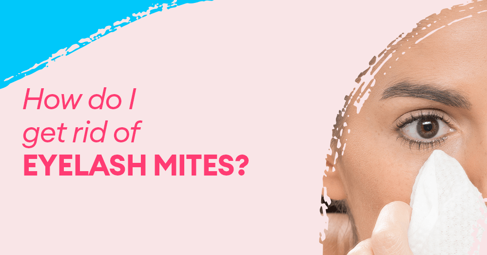 How do I get rid of eyelash mites?