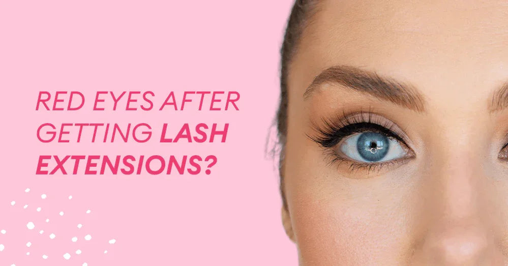 ¿Ojos rojos después de ponerse extensiones de pestañas?