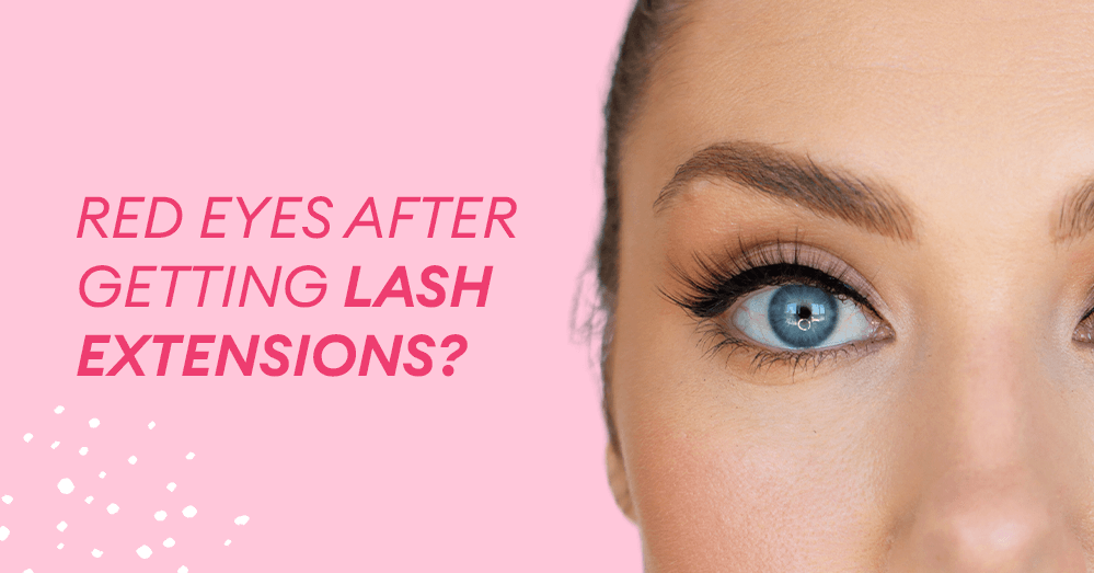Red eyes after getting lash extensions?