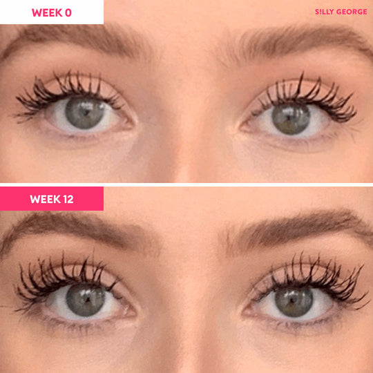 Lash Growth Serum Bundle - Silly George