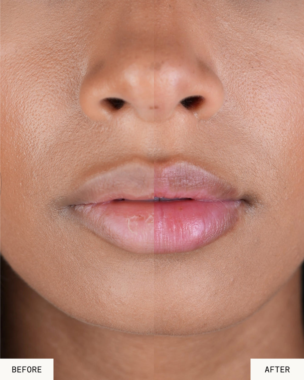 Lip Balm Recovery