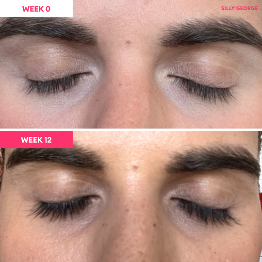 Lash Growth Serum Bundle