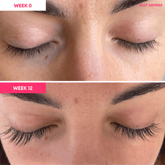 Lash Growth Serum Bundle - Silly George