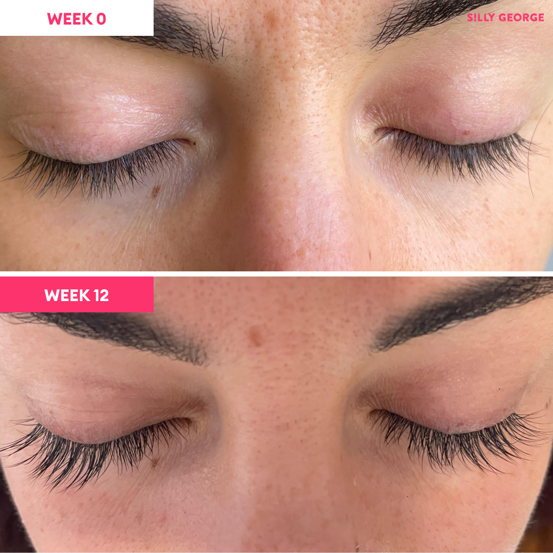 Lash Growth Serum Bundle