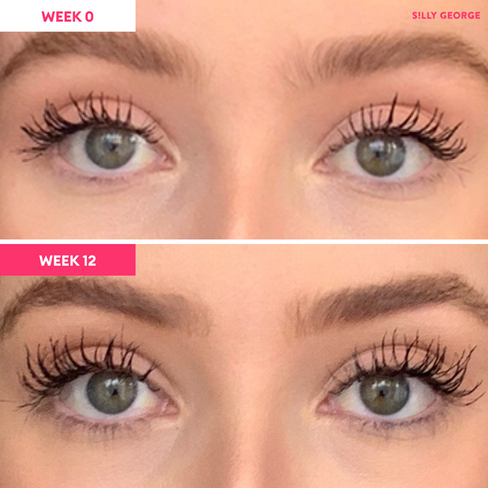 Lash Growth Serum Bundle