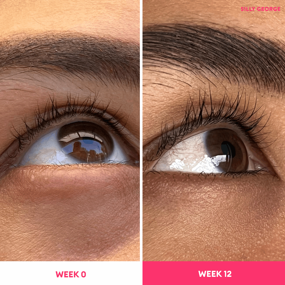 Lash Growth Serum Bundle – Silly George Lash Growth Serum Bundle – Silly George