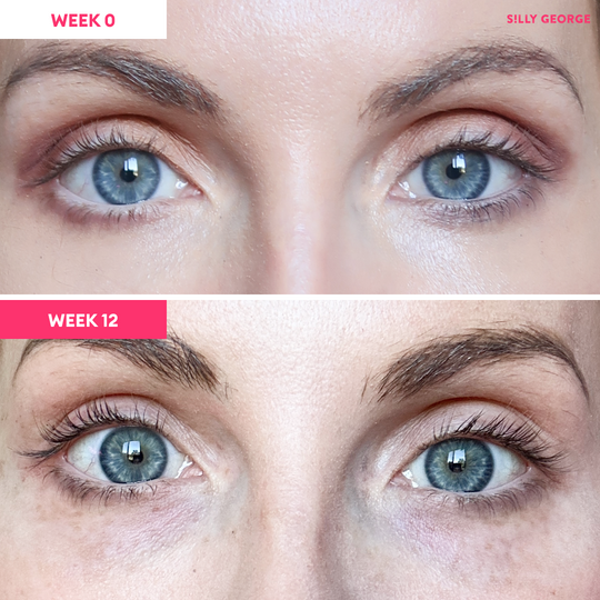Lash Growth Serum Bundle