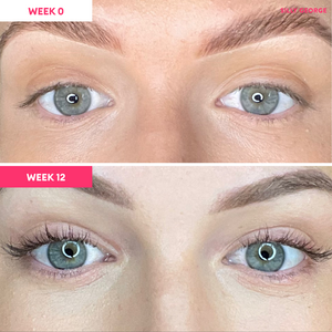 Lash Serum
