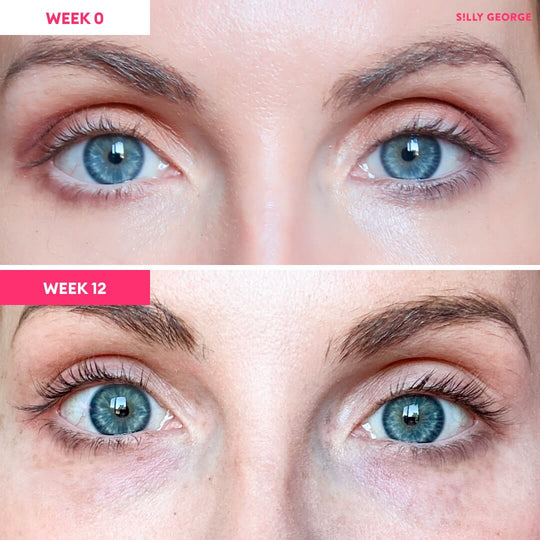"Lash Serum Lash & Brow Growth Treatments Silly George "