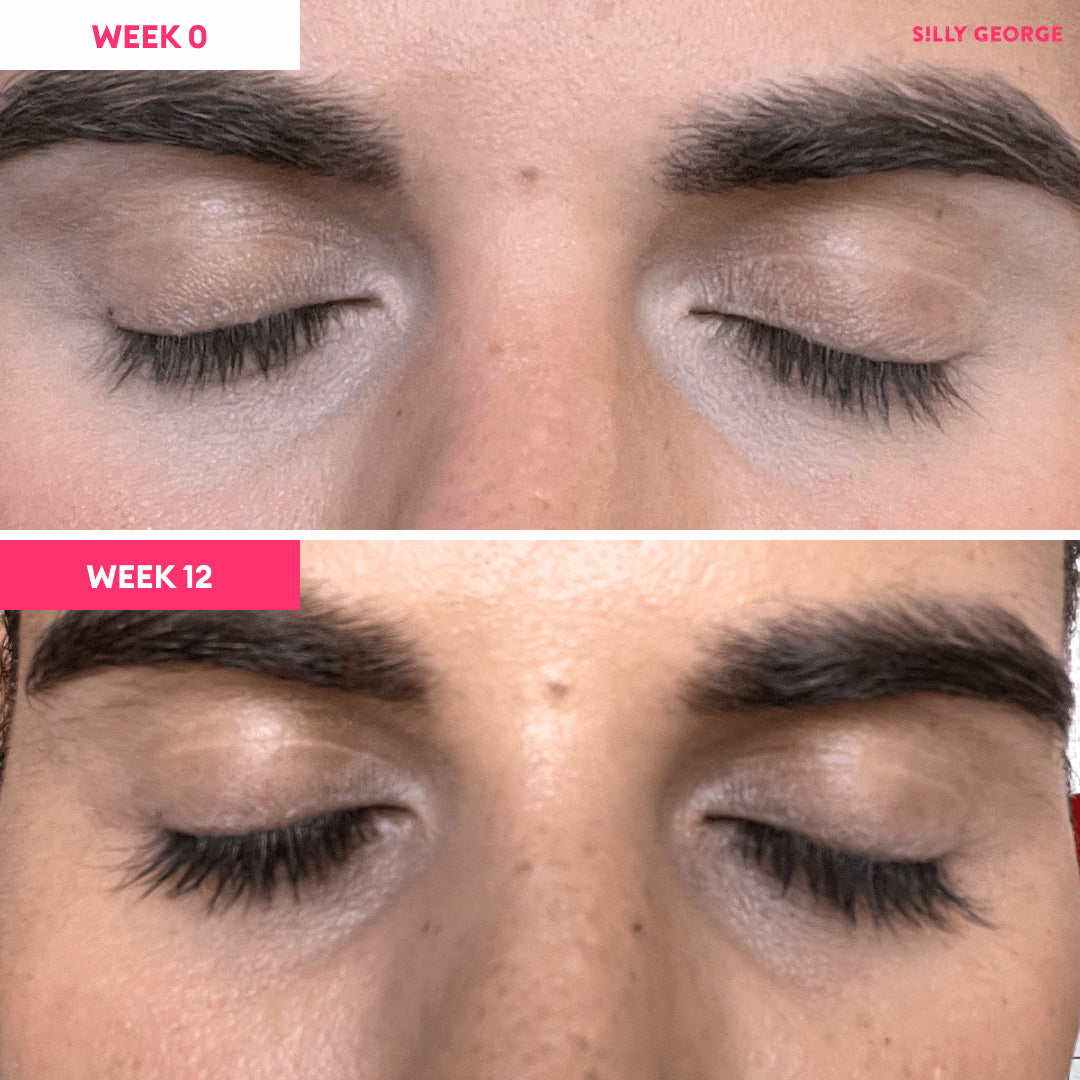 "Lash Growth Serum Bundle"